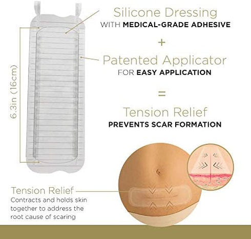 Embrace Active Scar Defense for New Scars, FDA-Cleared Silicone Scar Sheets, 6.3 Inch, X-Large, 30 Day Supply