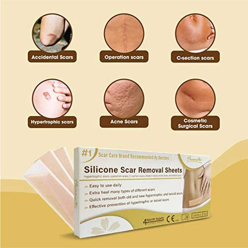 Silicone Scar Removal Sheets, Scar Away Silicone Scars Sheets for C-Section, Acne, Surgery Injuries, Keloid, Burn, Stretch Marks, Works on Recent & Old Scars, 4 Sheets 5.7’’ x 1.57”