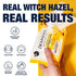 Dickinson's Original Refreshingly Clean Daily Cleansing Cloths, Witch Hazel and Aloe, 25 Count