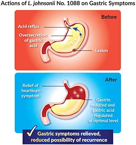 GASTRICELL - Eliminate H. Pylori, Relieve Acid Reflux and Heartburn, Regulate Gastric Acid - Targets The Root Cause of Recurring Gastric Problems, Natural Defence Against Gastric Distress -30 sachets