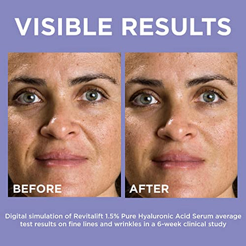L’Oreal Paris 1.5% Pure Hyaluronic Acid Serum for Face with Vitamin C from Revitalift Derm Intensives for Dewy Looking Skin, Hydrate, Moisturize, Plump Skin, Reduce Wrinkles, Anti Aging Serum, 1 Oz