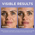 L’Oreal Paris 1.5% Pure Hyaluronic Acid Serum for Face with Vitamin C from Revitalift Derm Intensives for Dewy Looking Skin, Hydrate, Moisturize, Plump Skin, Reduce Wrinkles, Anti Aging Serum, 1 Oz