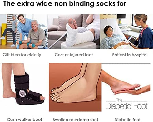 Extra Wide Socks for Lymphedema Swollen Feet Leg, Bariatric Socks, Medical Cast Sock, Diabetic Non Binding Socks – Neuropathy Swelling Feet Socks for Women Men(2 Pairs(White))