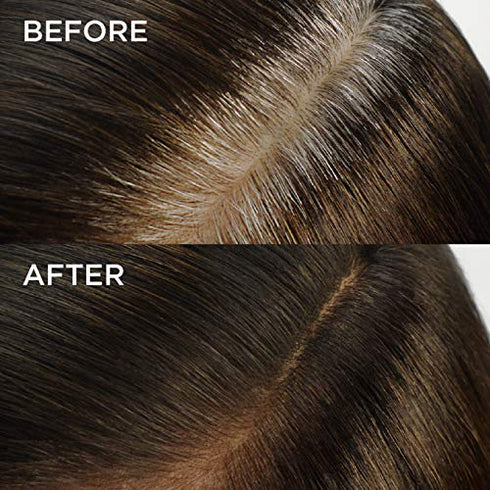 L'Oreal Paris Magic Root Rescue 10 Minute Root Hair Coloring Kit, Permanent Hair Color with Quick Precision Applicator, 100% Gray Coverage, 6 Light Brown, 2 count