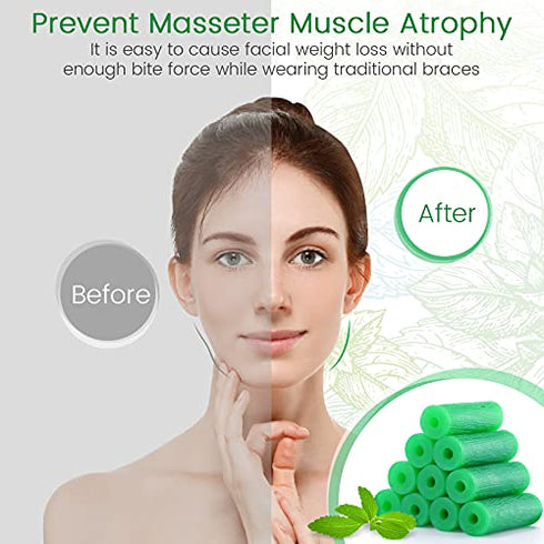 Aligner Chewies for Invisalign Aligners Mint Scented (20 Pcs Green) and Aligner Removal Tool (2 Pcs Blue)