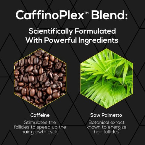 Ultrax Labs Hair Surge Shampoo for Thinning Hair Loss & Hair Growth, 8 oz