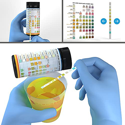 10-in-1 Dog and Cat Vet-10 Urine Test Strips 100ct, Veterinarian Lab Grade Pet Health Wellness Urinalysis Home Testing Kit, Detect UTI Urinary Tract Infections, Diabetes, Kidney and Liver Function