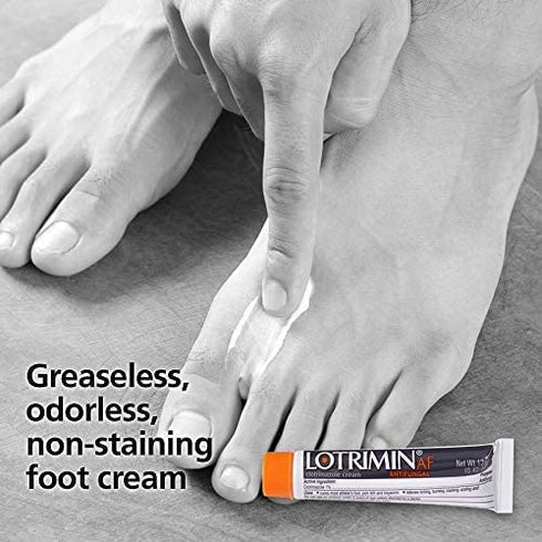 Lotrimin AF Cream for Athlete's Foot, Clotrimazole 1% Antifungal Treatment, Clinically Proven Effective Antifungal Treatment of Most AF, Jock Itch and Ringworm, Cream, .42 Ounce (12 Grams)