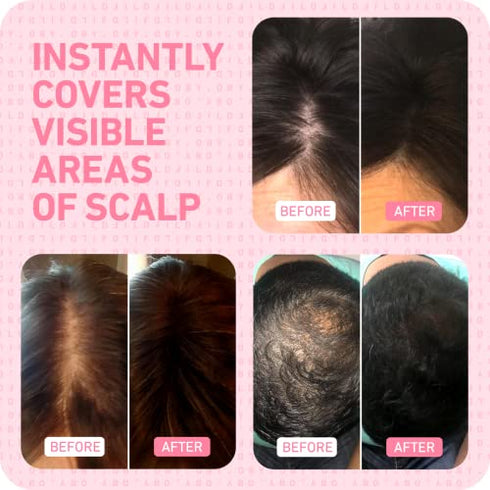 BOLDIFY Root Touch Up Powder (Dark Brown) - Hairline Powder Instantly Conceals Hair Loss, Stain-Proof 48 Hour Formula, Hair Powder for Thinning Hair, Root Cover Up, Hair Toppers for Women & Men
