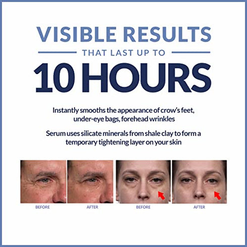 Plexaderm Rapid Reduction Eye Serum Pods - Advanced Formula - Anti Aging Serum Visibly Reduces Under Eye Bags, Wrinkles, Dark Circles, Fine Lines & Crow's Feet Instantly