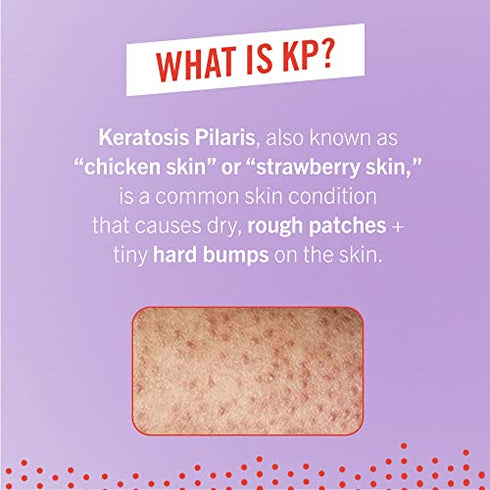 First Aid Beauty KP Bump Eraser Body Scrub Exfoliant for Keratosis Pilaris with 10% AHA 4 oz.