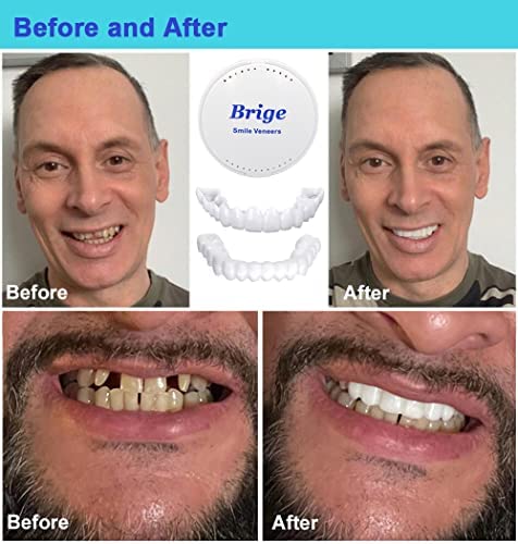 Denture Teeth Temporary Fake Teeth for Snap on Instant & Confidence Smile