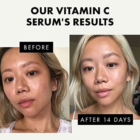 PURE Vitamin C Serum for Face, 20% Vit C Serum WITH HYALURONIC ACID+RETINOL+FERULIC ACID+VIT E-Anti Aging Serum for Glowing Skin-Skin Brightening Serum-Antioxidant Serum-Reduce Wrinkles & Dark Spots