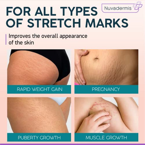 Stretch Mark Cream - Prevention & Remover of StretchMarks - Maternity & Pregnancy Skin Care - Collagen, Jojoba & Olive Oil, Allantoin - Belly Lotion for Pregnant Women - Hydrates,Smoothes,Renews 4 oz