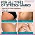 Stretch Mark Cream - Prevention & Remover of StretchMarks - Maternity & Pregnancy Skin Care - Collagen, Jojoba & Olive Oil, Allantoin - Belly Lotion for Pregnant Women - Hydrates,Smoothes,Renews 4 oz