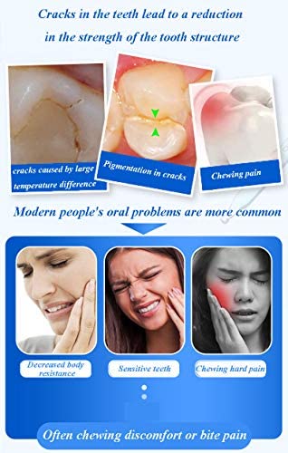 CAREDO Healing Teeth Crack Toothpaste, The ONLY Toothpaste Repairing Cracked Teeth Enamel Cracks, Cure Tooth Sensitivity, Root Damage Teeth Displacement Treatment, Remove Pigment in Crack 100g 1 Count