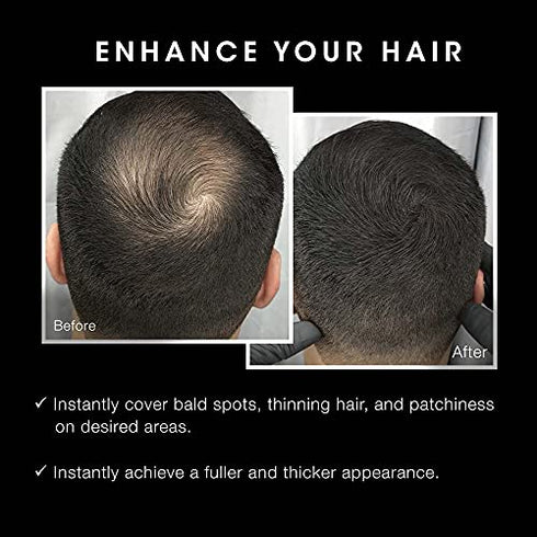 Pacinos Hair Fibers (Dark Brown) - Thickening Fibers Achieve Fuller Appearance by Concealing Thinning Hair & Bald Spots, Includes Applicator Pump Nozzle