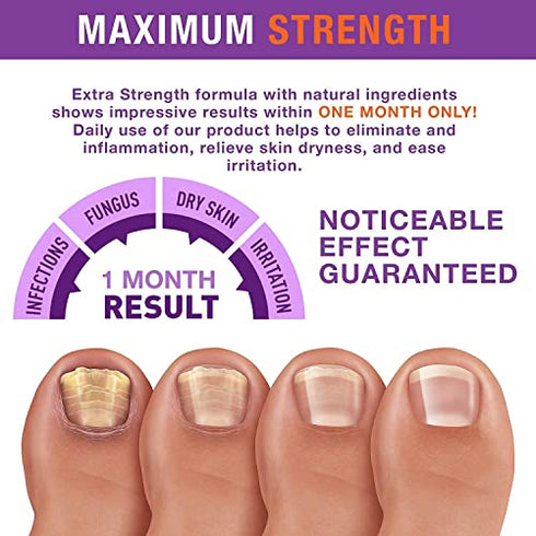 pureskin Fungal Nail Renewal - Maximum Strength Nail Fungus Treatment, Toe Fungus Nail Treatment, Health Care Solution for Finger & Toenail Fungus, Athlete's Foot, Ringworm by Fungus
