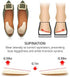 Dr. Shoesert Supination & Over-Pronation Inserts, Medial & Lateral Heel Insoles for Foot Alignment, Knee Pain, Bow Legs, Osteoarthritis - 2 Pairs (Medium - Women's 8-11.5|Men's 6-10.5)