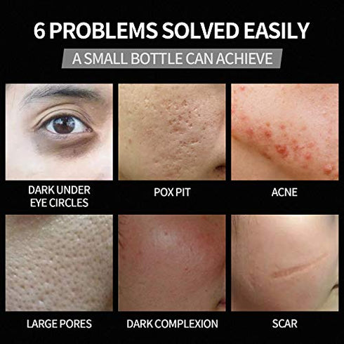 immetee BB Cream for Men, Tinted Moisturizer for Face, Concealer for Dark Circles & Spots, Mens Skincare and Evens Skin Tone Sunscreen PA++ 12 hours Lasting?Bronze?