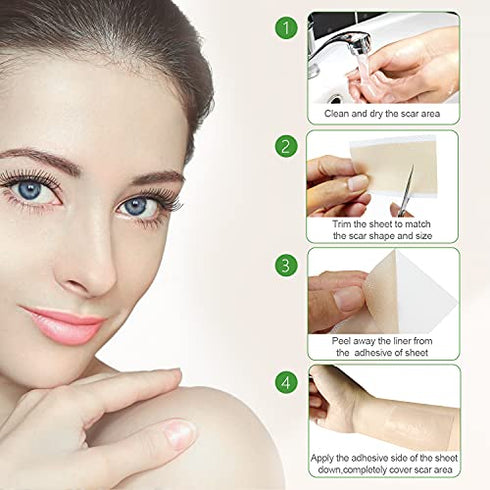 Silicone Scar Sheets, Professional Removal Sheets for Keloid Bump Scars, Surgical Scar, Burn Scars, Acne Scars, Tummy Tuck Post Surgery Supplies, Soft Long Strips 1.6"¡Á3", 10 Sheets
