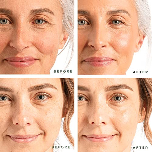 Tree of Life Firming Retinol Serum and Hydrating Hyaluronic Acid, Set to Glow Facial Serum Duo, 2 Count x 1 Fl Oz