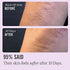 First Aid Beauty KP Bump Eraser Body Scrub Exfoliant for Keratosis Pilaris with 10% AHA 2 oz.