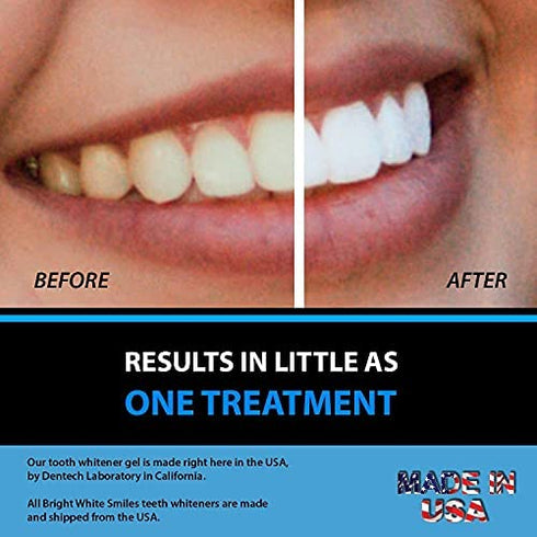 Bright White Smiles - Teeth Whitening Gel Refill Kit - 10 Tubes 44% Carbamide Peroxide Tooth Whitener Formula