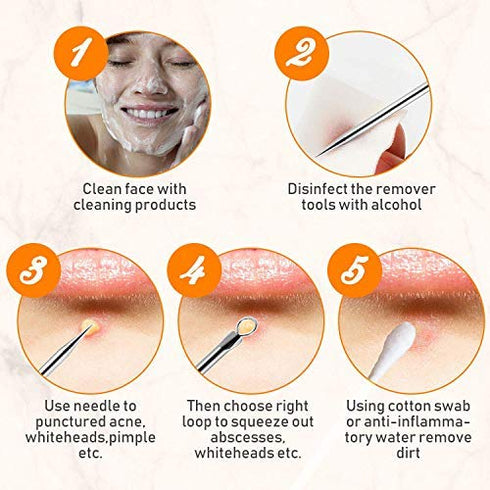Blackhead Remover Tool, Aooeou Professional Pimple Popper Tool Kit - Treatment for Blemish, Whitehead Popping, Zit Removing for Risk Free Nose Face, Anti-Slip Coating Handle (b-Silver)