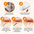 Blackhead Remover Tool, Aooeou Professional Pimple Popper Tool Kit - Treatment for Blemish, Whitehead Popping, Zit Removing for Risk Free Nose Face, Anti-Slip Coating Handle (b-Silver)