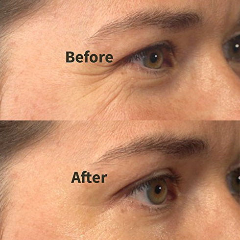 Instant Firming Maxi Lift Serum - Two Minute Face Lift For A Younger Look