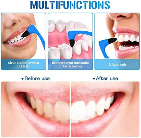 2 Pack Teeth Tablets Remover/Cleaner,Tooth Tablets Plaque/Tartar Remover,Dental Tartar Removal Pulisher,Polishing Whitening/Cleaning Tools(Random Color)