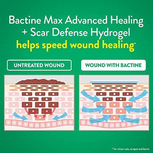Bactine Max Advanced Healing + Scar Defense Hydrogel, Faster Healing, Reduces Appearance of Scars and First Aid Infection Protection, 0.75oz