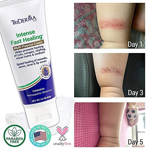 TriDerma Intense Fast Healing Multi-Purpose Cream for Cuts, Scrapes, Sores, Chafing, Minor Burns and Sunburn (2.2 oz Tube)
