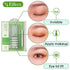 400Pcs Natural Invisible Single Side Eyelid Tape Stickers Medical-use Fiber Eyelid Lift Strip, Instant Eye Lift Without Surgery, Perfect for Uneven Mono-Eyelids, 100 Pairs Slim + 100 Pairs Wide