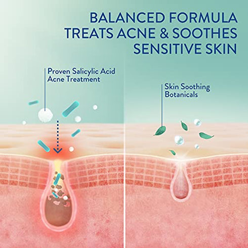 Cetaphil Face Moisturizer, Gentle Clear Mattifying Acne Moisturizer With 0.5% Salicylic Acid, Hydrates and Treats Sensitive Acne Prone Skin, Skin Care for Sensitive Skin, 3oz