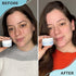AYADARA Cystic, Hormonal & Severe Acne Spot Treatment, Natural Pimple Cream with Salicylic Acid & Tea Tree for Teens & Adults, Zit, Milia, & Blemish Minimizer for a Clean Face & Body, 150+ Treatments