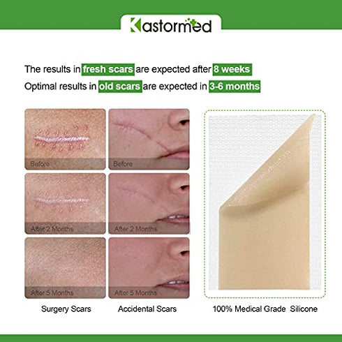 Silicone Scar Sheets, Professional Removal Sheets for Keloid Bump Scars, Surgical Scar, Burn Scars, Acne Scars, Tummy Tuck Post Surgery Supplies, Soft Long Strips 1.6"¡Á3", 10 Sheets