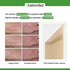 Silicone Scar Sheets, Professional Removal Sheets for Keloid Bump Scars, Surgical Scar, Burn Scars, Acne Scars, Tummy Tuck Post Surgery Supplies, Soft Long Strips 1.6"¡Á3", 10 Sheets