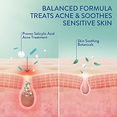 Cetaphil Acne Face Wash, Gentle Clear Clarifying Acne Cream Cleanser with 2% Salicylic Acid, Deep Cleans & Treats Acne Prone Skin, Skin Care for Sensitive Skin, 4.2oz