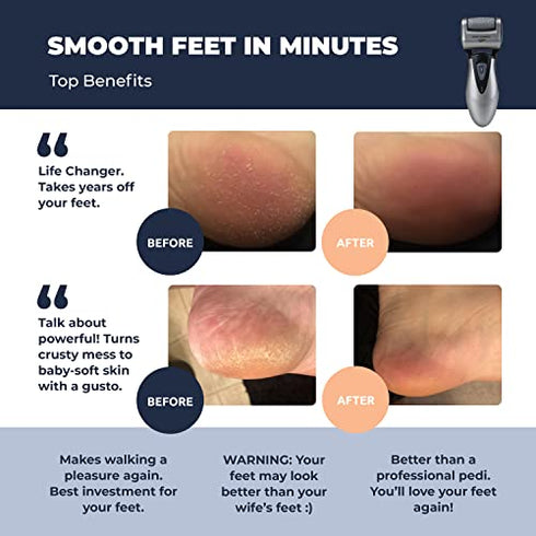 Electric Foot Callus Remover, Feet Scrubber: Own Harmony Rechargeable Mens Pedicure Tools Kit, Professional Electronic Foot Care File, Best for Hard Cracked Dead Skin and Powerful Pedi Spa, 3 Rollers