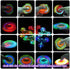 Fidget Spinner, Crystal Fidget Toy Led Light Rainbow Finger Toy Hand Fidget Spinner-Kids for ADHD Anxiety Stress Reducer(Pink)