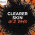 Bioré Charcoal Acne Face Scrub, with 1% Salicylic Acid and Natural Charcoal, Helps Prevent Breakouts and Absorb Oil for Deep Pore Cleansing, 4.5 Ounce (HSA/FSA Approved)