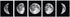 5 Pieces Moon Wall Decor - Black and White Canvas Print Artworks Lunar Moon Wall Art Abstract Prints Poster for Office Dorm Living Room Bedroom Decoration Unframed Paintings Home Decor