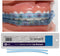Element Braces Comfort Lip Bumper (Blue) - Orthodontic - Dental