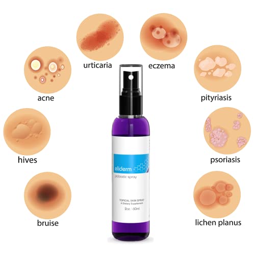 Topical Probiotic Spray For Skin - 13 Strains Live Probiotic Skin Care ...